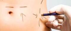 cirurgia-plastica-em-botucatu-1439320218