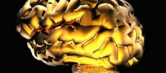 neurologia-em-botucatu-1439400330