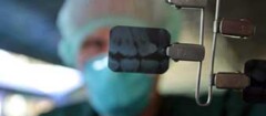 radiografia-odontologia-em-botucatu-1439403088